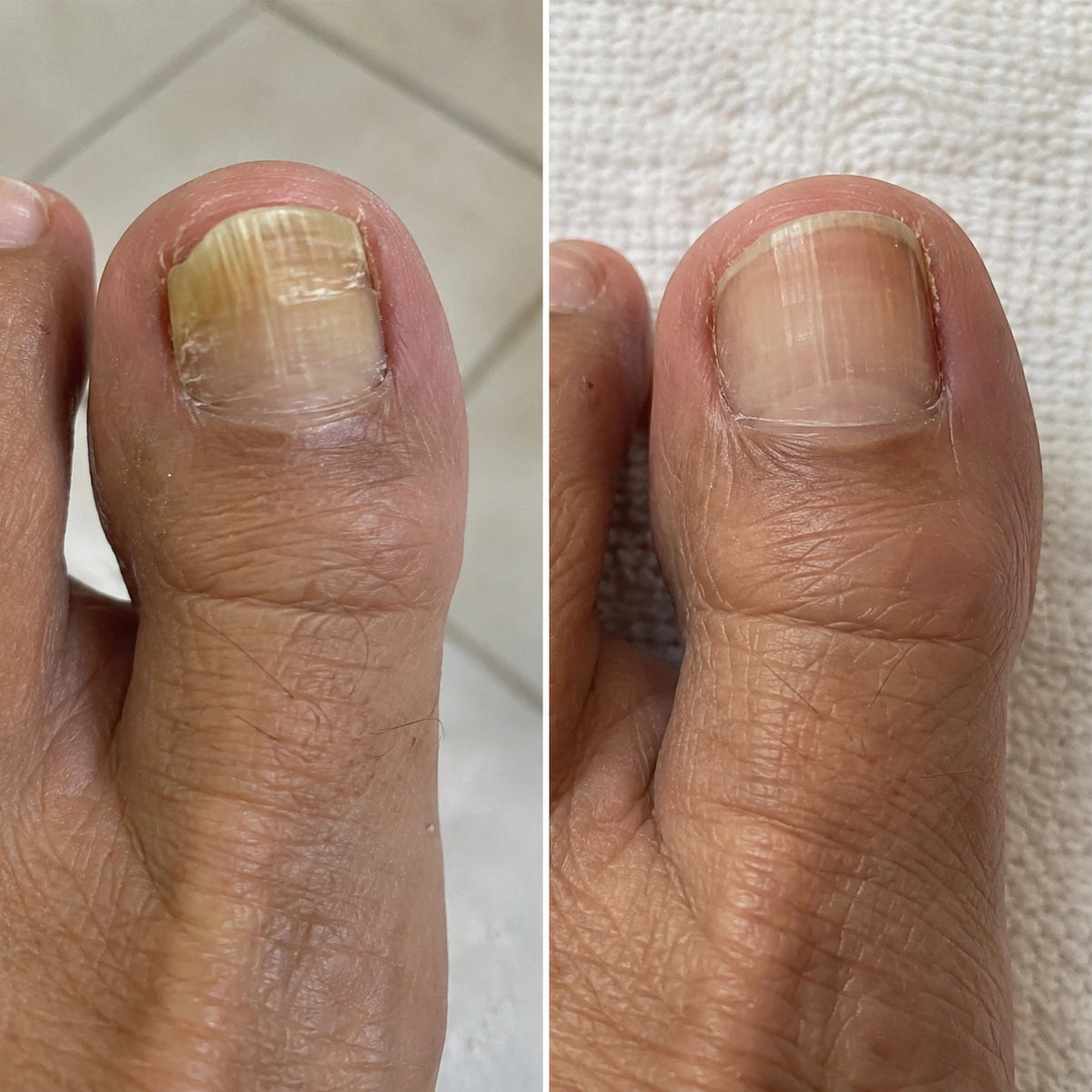 NailRestore WebP