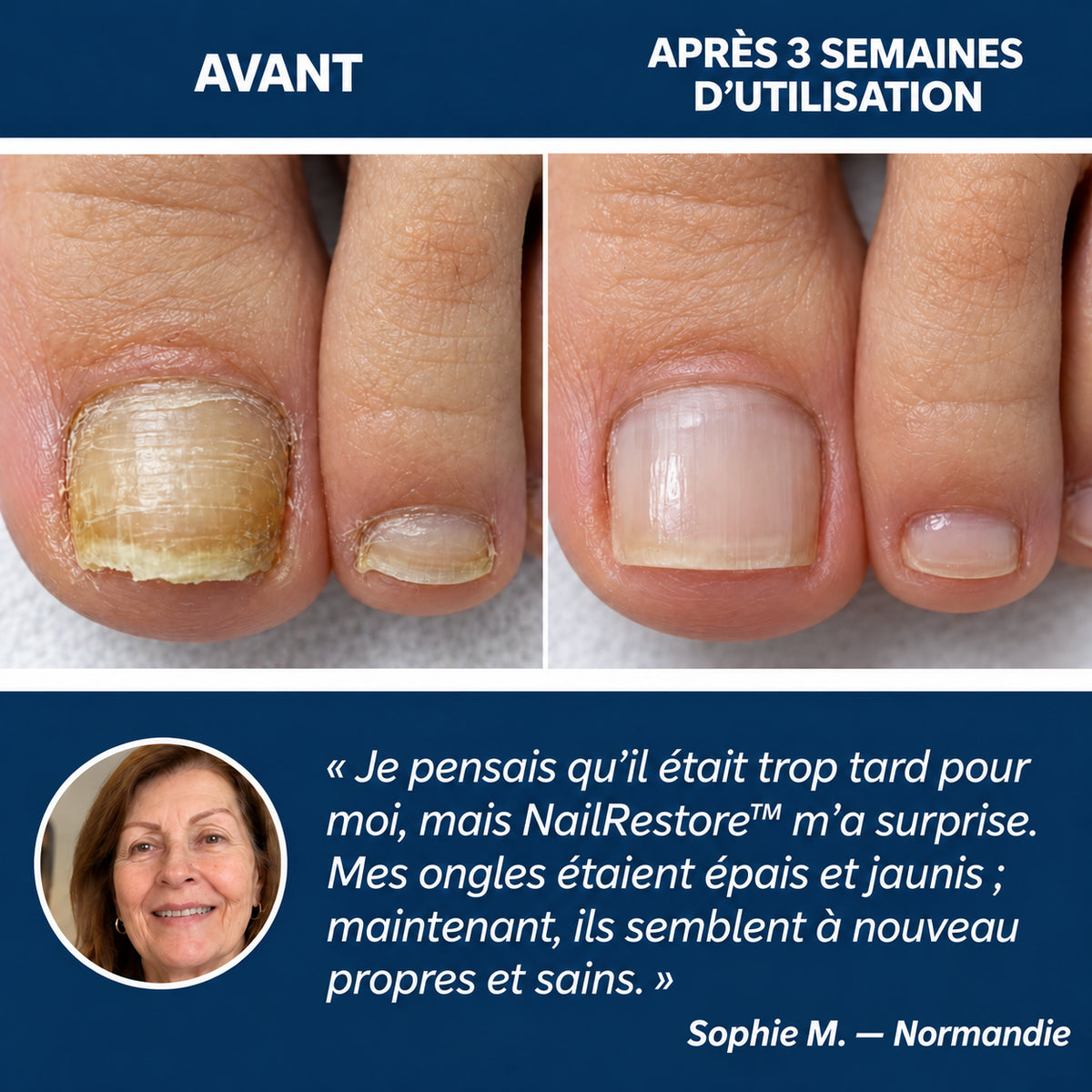 NailRestore