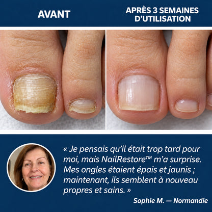 NailRestore