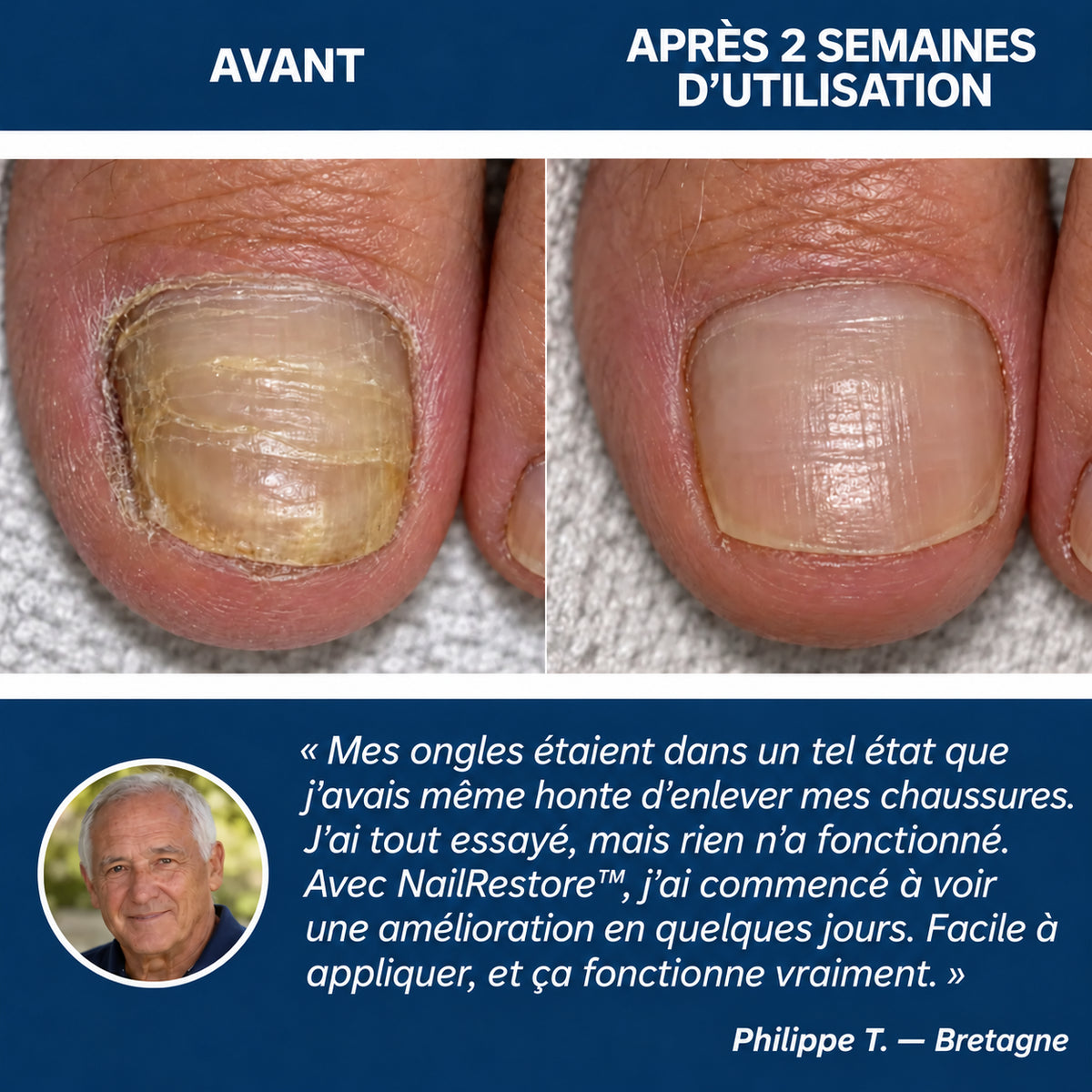 NailRestore