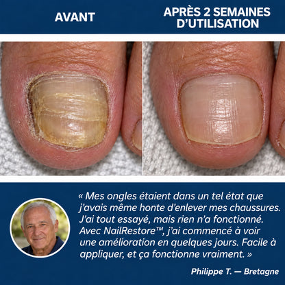 NailRestore