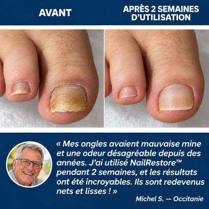 NailRestore