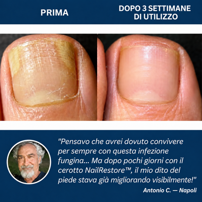 NailRestore – Cerotti adesivi antimicotici