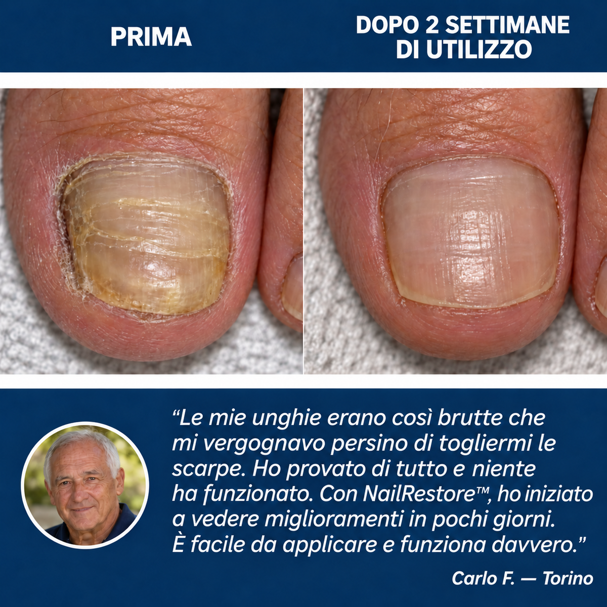NailRestore – Cerotti adesivi antimicotici