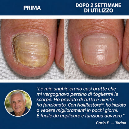 NailRestore WebP