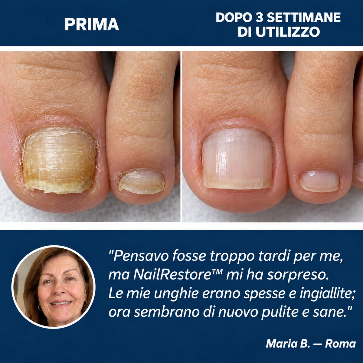 NailRestore WebP