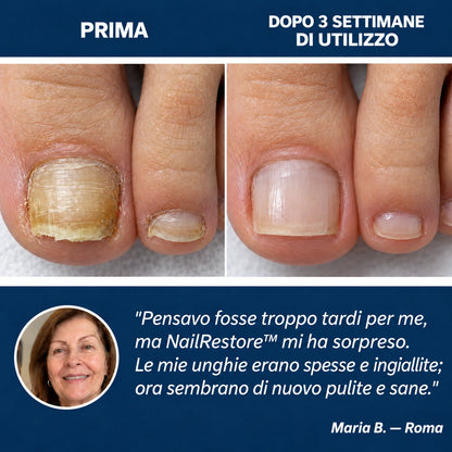 NailRestore WebP