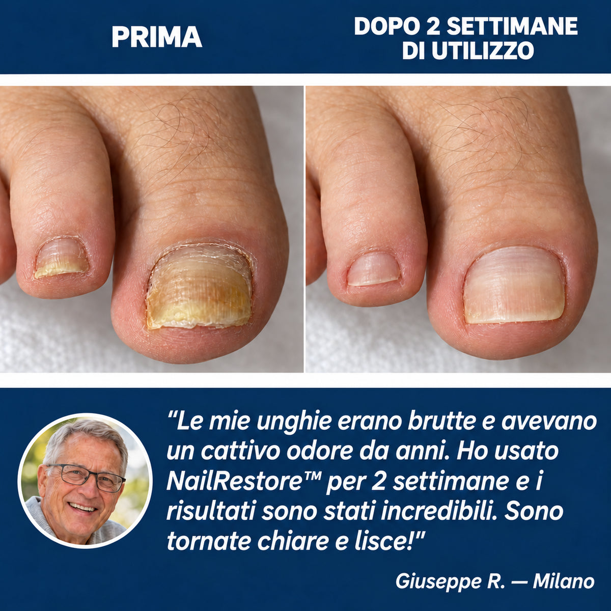 NailRestore WebP
