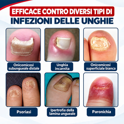 NailRestore WebP