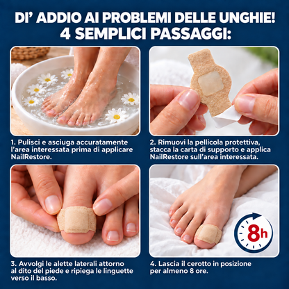 NailRestore – Cerotti adesivi antimicotici