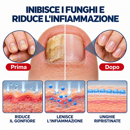NailRestore – Cerotti adesivi antimicotici