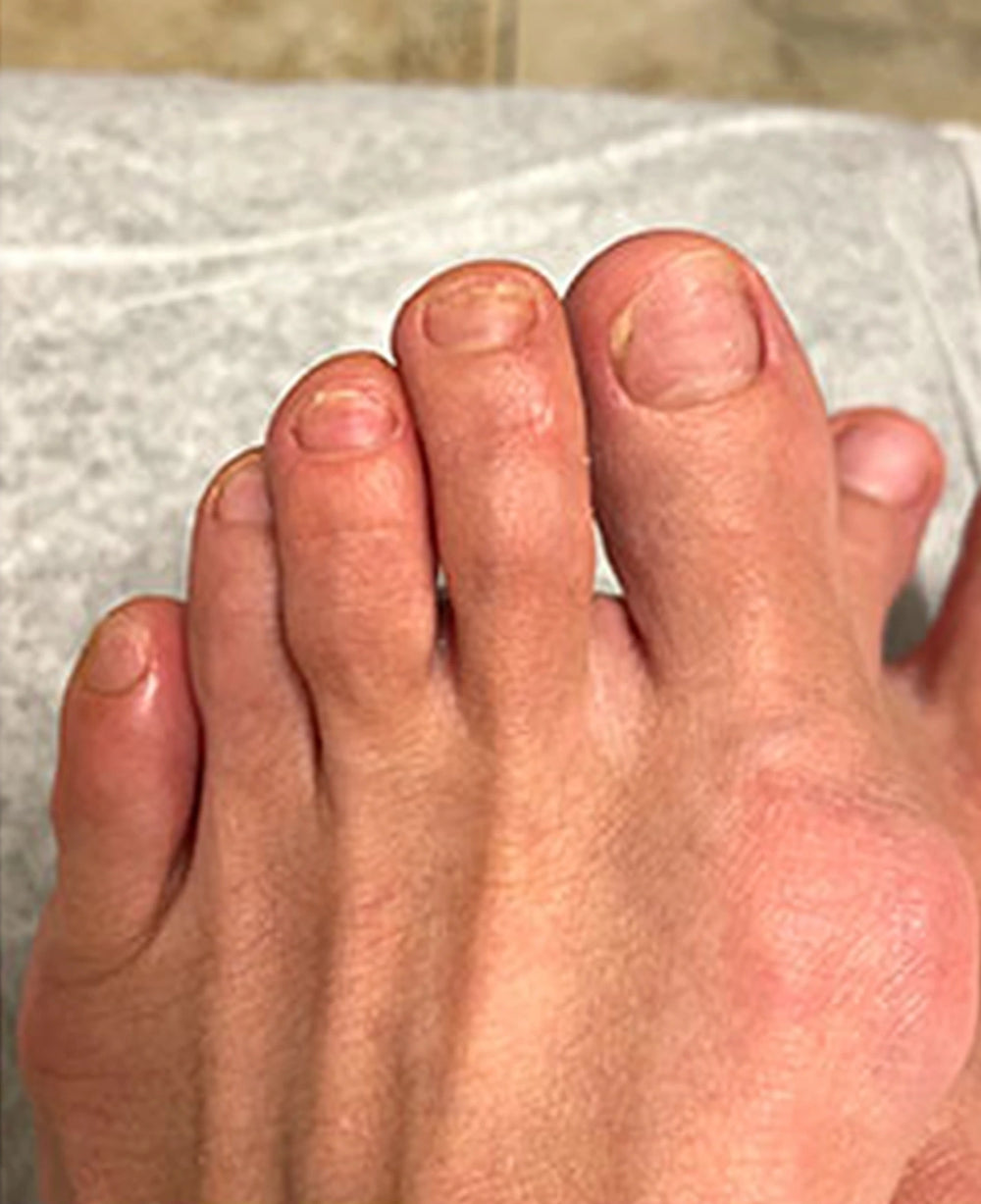 mendlys nailrestore comparison after hq 20261006