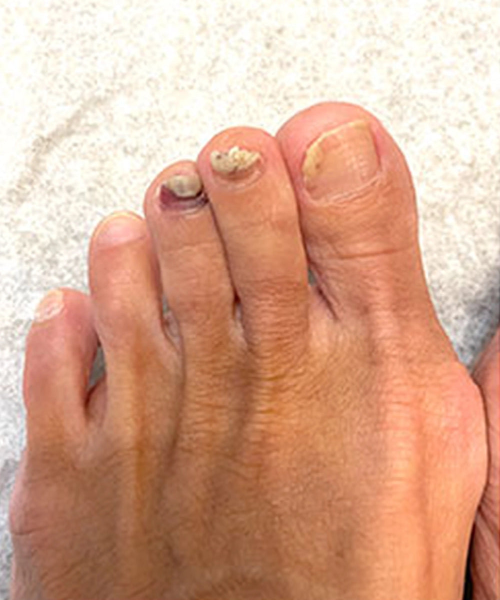 mendlys nailrestore comparison before hq 20261006