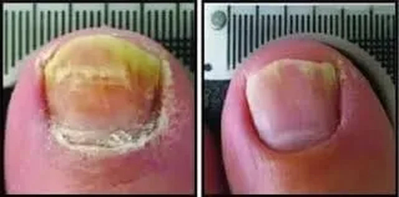 mendlys nailrestore review 3 hq 20261006