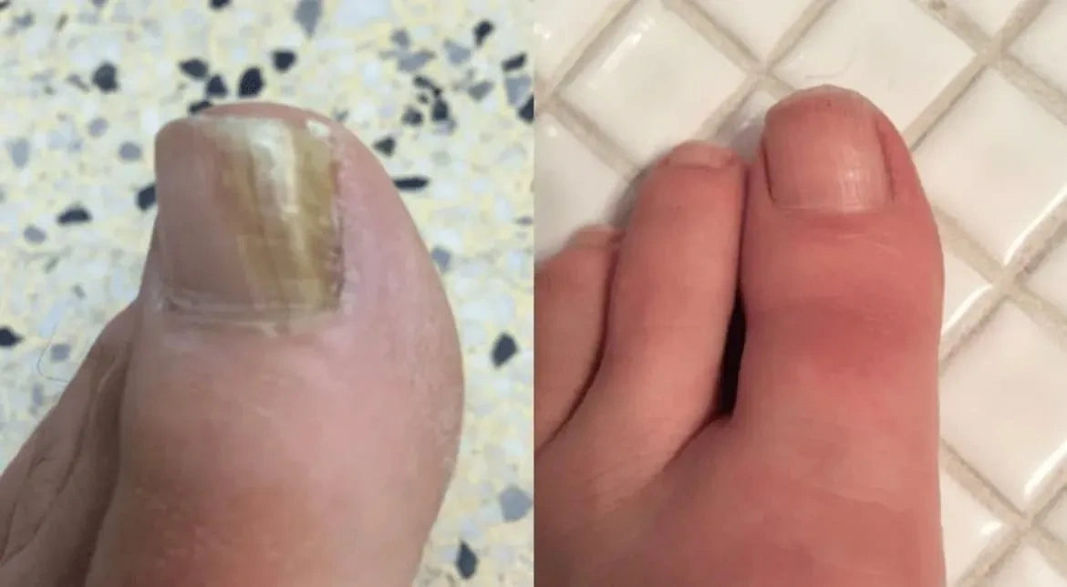 mendlys nailrestore review 5 hq 20261006